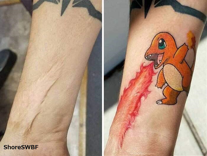 Pokemon fan uses Charmander tattoo to cover up a scar  The GoNintendo  Archives  GoNintendo